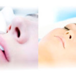 1323507690_mesotherapy